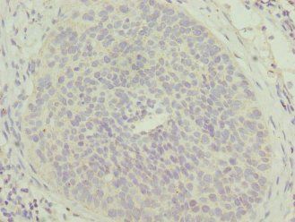 MTFP1 Antibody