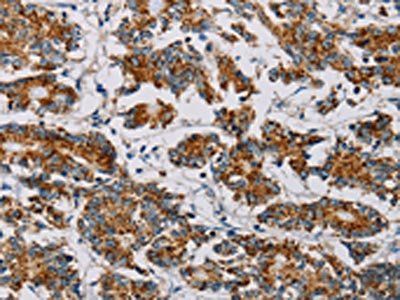 MTFP1 Antibody