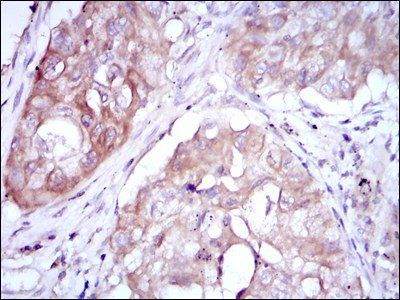MTHFR Antibody