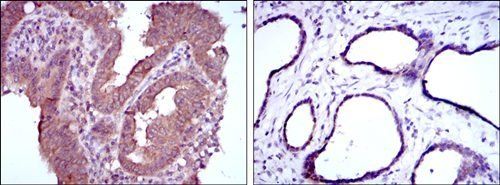 MTHFR Antibody
