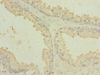 MTIF3 Antibody