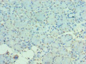 MTM1 Antibody