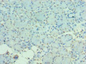 MTM1 antibody