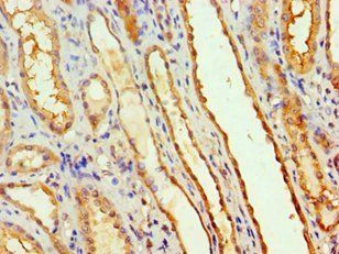 MTMR14 Antibody
