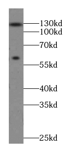 MTMR15 antibody