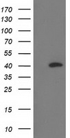 MTMR2 antibody