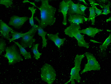 MTMR3 Antibody