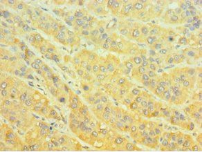 MTMR4 Antibody