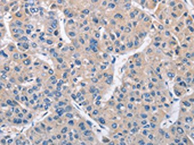MTMR4 Antibody