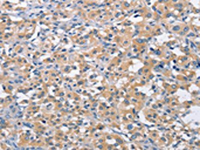 MTMR4 Antibody