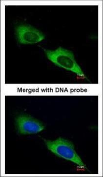 MTMR9 antibody [C3], C-term