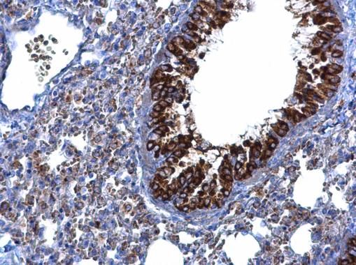 MTMR9 Rabbit Polyclonal Antibody
