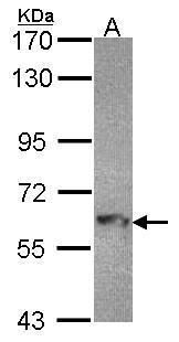 MTMR9 Rabbit Polyclonal Antibody