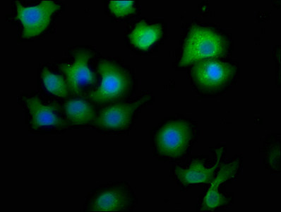MTMR9 Antibody