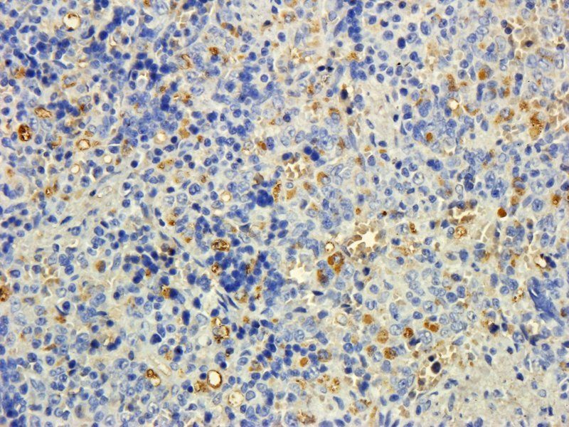 Goat anti-MTMR9 (C Terminus) Antibody