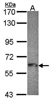 MTMR9 antibody