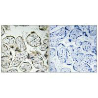 MT-ND1 Antibody