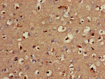 MTNR1B Antibody