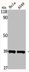 MTNR1B antibody