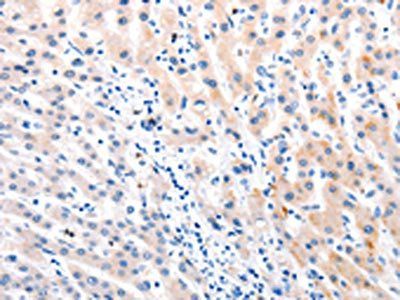 MTOR Antibody