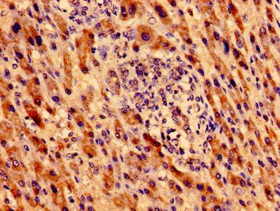 MTRF1 Antibody
