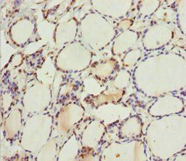 MTUS1 Antibody