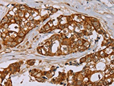 MTUS1 Antibody