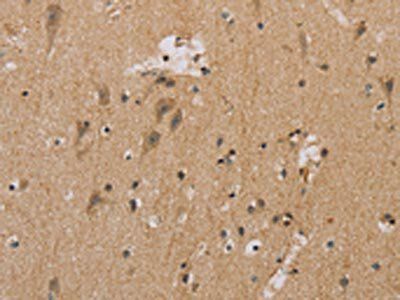 MTUS1 Antibody