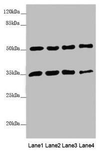 MTX1 antibody