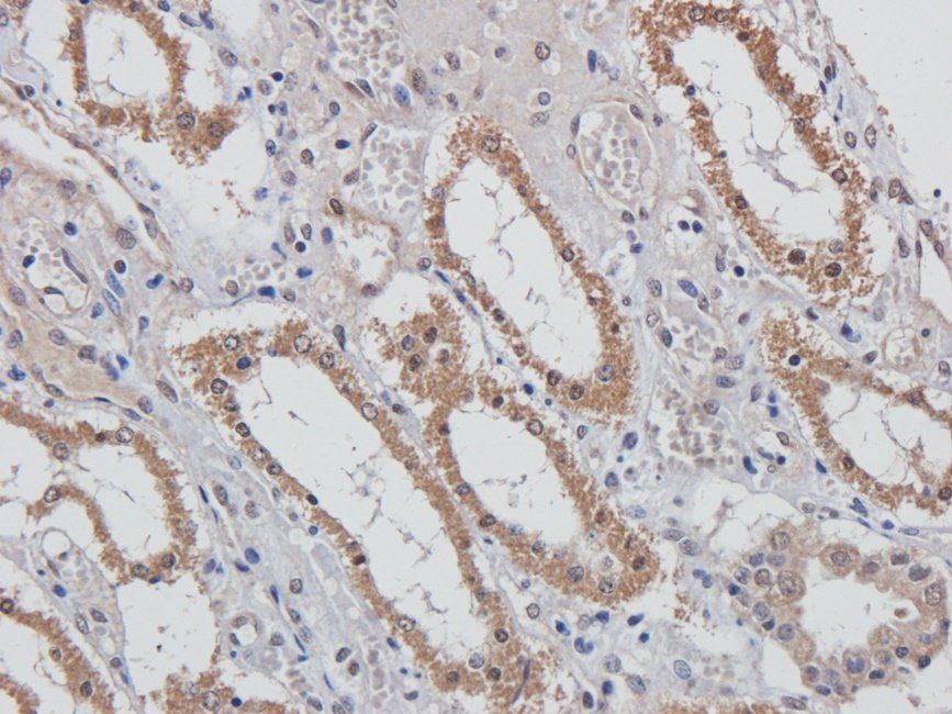 MUC1 antibody