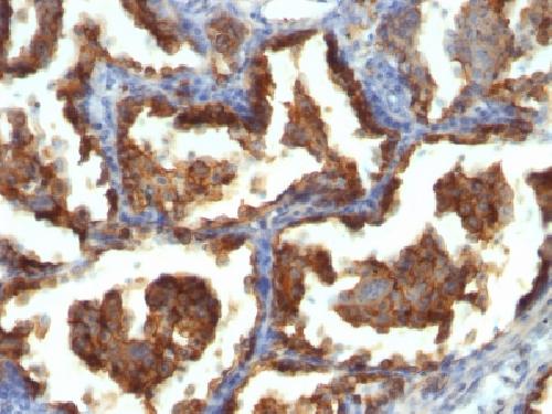 MUC1 / CA15-3 / EMA / CD227 (Epithelial Marker) Antibody