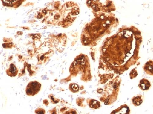 Recombinant MUC1 / CA15-3 / EMA / CD227 (Epithelial Marker) Antibody