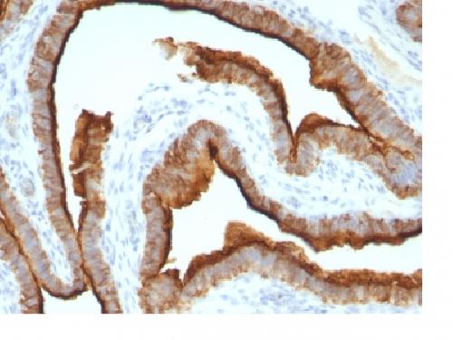 MUC1 / CA15-3 / EMA / CD227 (Epithelial Marker) Antibody