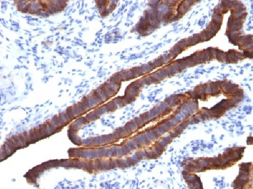 MUC1 / CA15-3 / EMA / CD227 (Epithelial Marker) Antibody