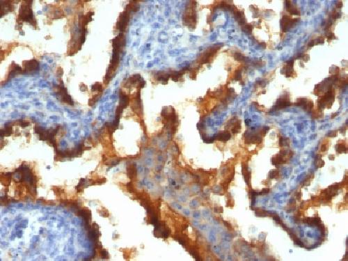 MUC1 / CA15-3 / EMA / CD227 (Epithelial Marker) Antibody