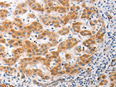 MUC13 antibody