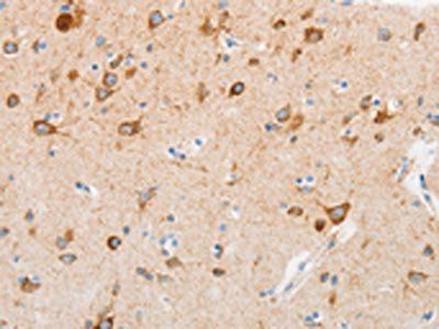 MUC13 Antibody