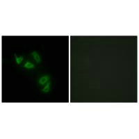 MUC13 antibody