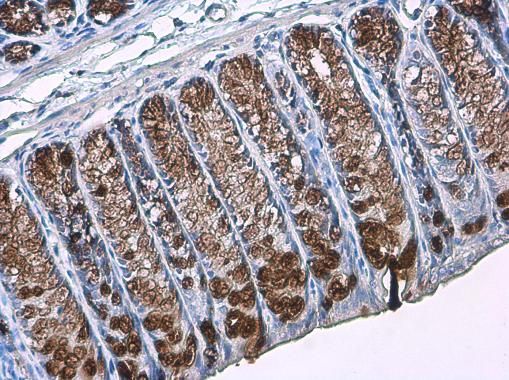 MUC2 Rabbit Polyclonal Antibody