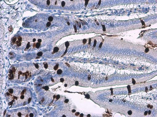 MUC2 Rabbit Polyclonal Antibody