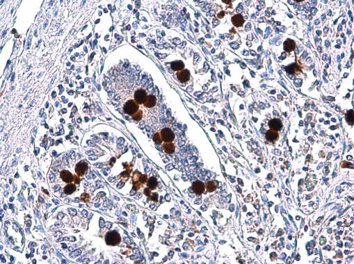 MUC2 Rabbit Polyclonal Antibody