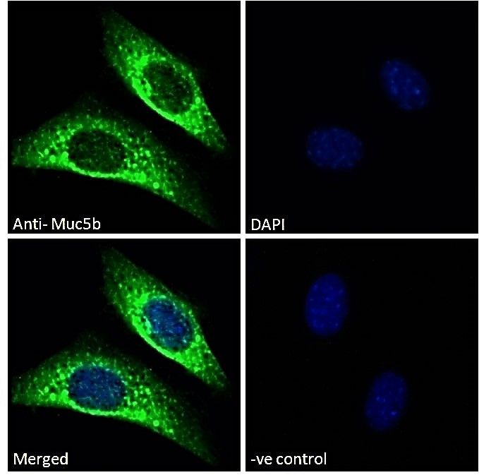 Muc5B antibody