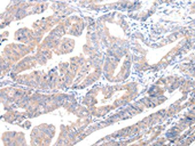 MUC7 antibody