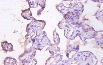 Mucin-1 antibody