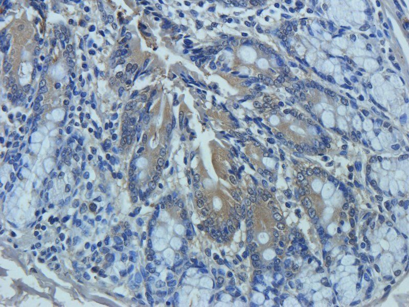 Mucin 5AC antibody