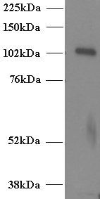 Goat anti-Munc13-4 / UNC13D (C terminus) Antibody