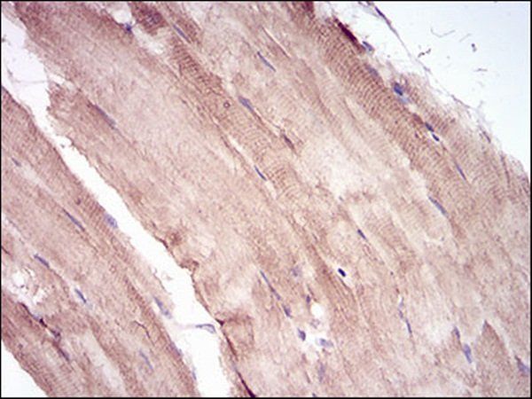 MuRF1 Antibody