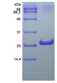 Murine FGF-21 protein