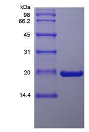 Murine Oncostatin M protein