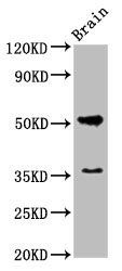 Muscarinic acetylcholine R M1 antibody